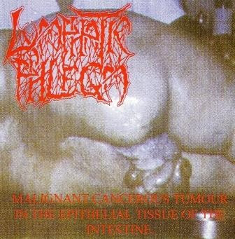 Malignant Cancerous Tumour in the Epithelial Tissue of the Intestine / From Rotten Process... To Splatter Cover